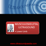Musculoskeletal Ultrasound Musculoskeletal Ultrasound